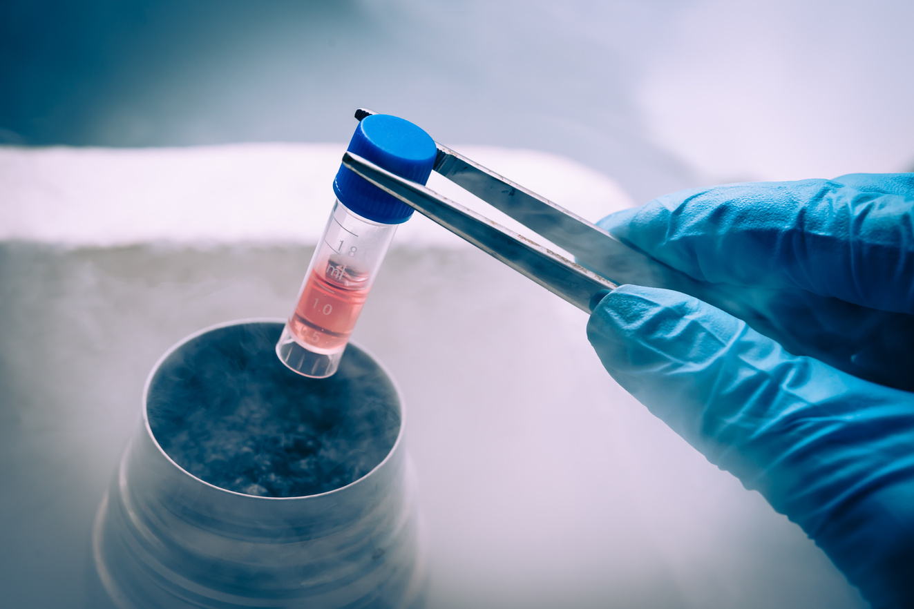 Liquid Nitrogen bank containing suspension of stem cells